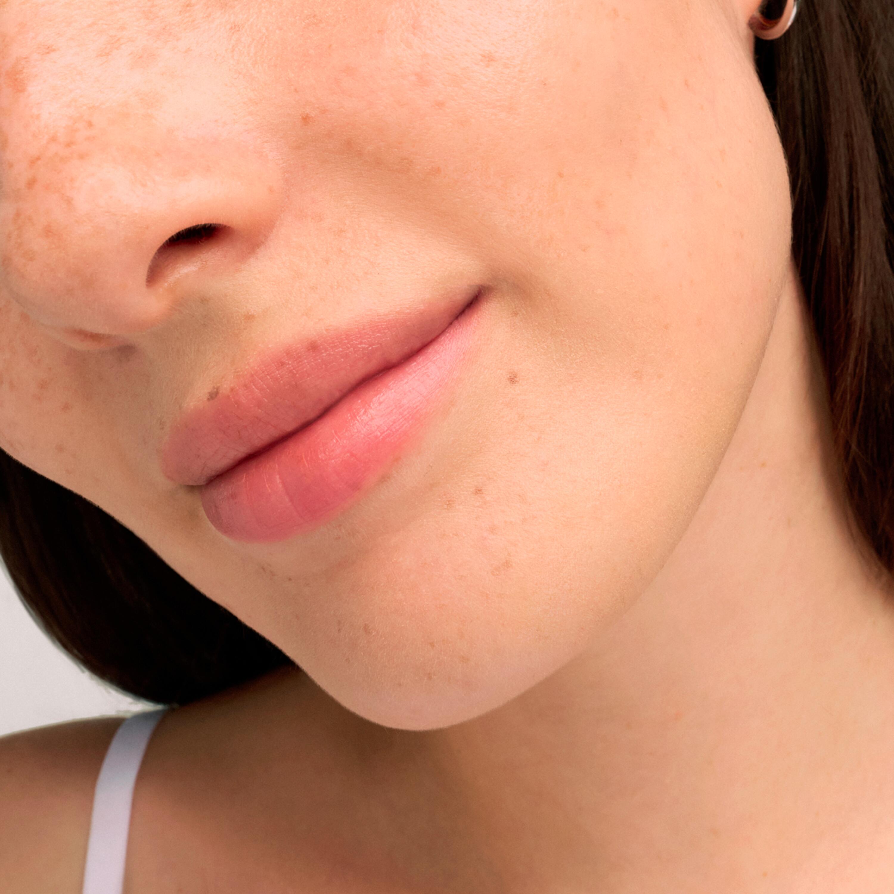 Peau sèche à très sèche